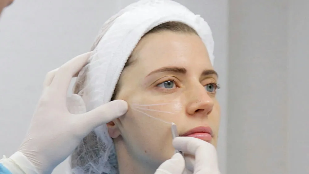 Descubriendo la Armonización Facial: Un Enfoque Innovador en Estética