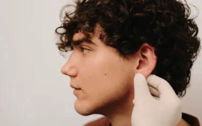 Marcación Mandibular en Málaga: Definición y Armonía Facial